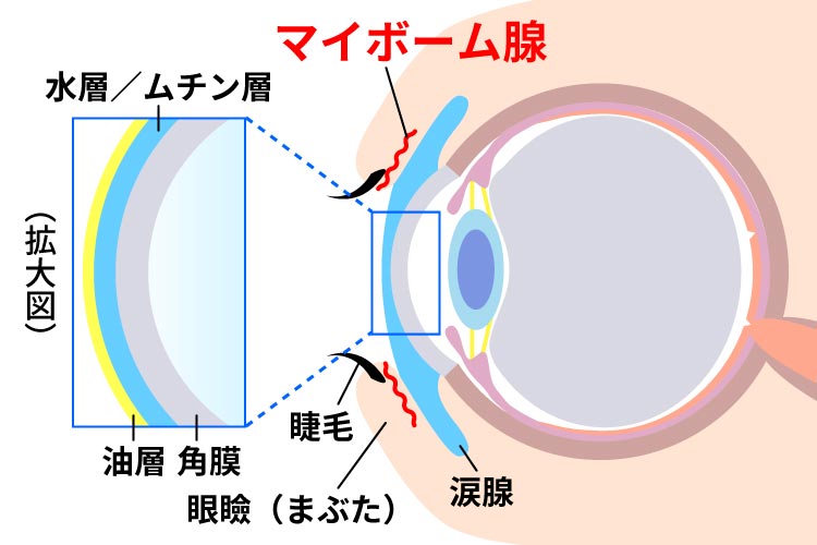 マイボーム腺機能不全