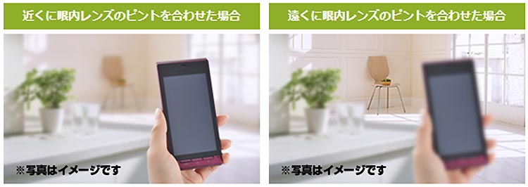 多焦点眼内レンズのイメージ写真